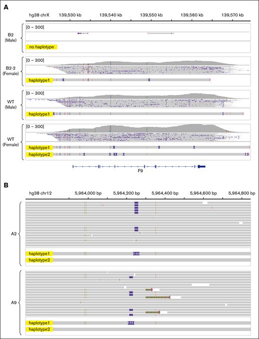 Detection of other SVs. (A) Sequencing results and de novo assembly of the F9 gene in B2 and B2-2. No haplotypes were assembled in B2, and only 1 set of haplotypes was assembled in B2-2, whereas 1 set of haplotypes is present in WT males, 2 sets of haplotypes are present in WT females. (B) Sequencing results and de novo assembly showed the insertions in VWF intron 47 in A2 and A9. These variants do not affect the function of VWF. Chr12, chromosome 12; ChrX, X chromosome; WT, wild-type.