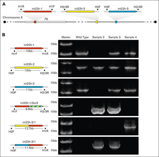 Conventional LR-PCR methods for int22h-related rearrangements. (A) H1F, H2F, H3F, H1R, and H2/3R are the 5 primers used in the LR-PCR experiments in this study, and the binding sites of the primers are labeled in the figure. (B) The combination of different primers can amplify int22h and fusion fragments. The electrophoresis results showed that LR-PCR amplified the expected DNA sequences for samples from a healthy control (wild-type) and patients 2, 3, and 4. The marker bands are 15 kb and 10 kb, respectively.