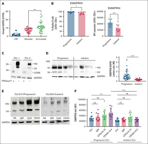 HG-EMMPRIN is upregulated in patients with progressive CLL. (A) EMMPRIN mRNA expression levels were quantified by qPCR in HDs and M-IGHV and UM-IGHV patients with CLL. (B) EMMPRIN protein levels in B-CLL cells of progressive and indolent patients were assessed by FC. Relative expression of percent positive cells and MFI analysis demonstrated higher levels of EMMPRIN in B-CLL cells of progressive patients than indolent patients. (C) CLL PBMC protein lysates were treated with PNGase F, and EMMPRIN expression was analyzed by western blot. GAPDH detection (bottom) was performed as loading control. The HG and LG forms are visible in untreated samples. The protein core is exposed after PNGase F treatment, confirming N-type glycosylation. (D) Representative blot of EMMPRIN in patients with progressive and indolent CLL, and relative protein expression was normalized to GAPDH. (E) Representative western blot of EMMPRIN expression in 1 patient with progressive CLL and 1 with indolent CLL after PBMC stimulation with IgM, CPG+IL15, and CD40L+IL4. (F) FC analysis of EMMPRIN expression upon stimulation with IgM, CPG+IL-15, and CD40L+IL-4 (n = 10 per group). ∗∗∗∗P < .0001; ∗∗∗P < .001; ∗∗P < .005; ∗P < .05 panels A-E, unpaired t test; panel G, t test. Ctrl, control of unstimulated cells; LG, low glycosylated; MFI, median fluorescence intensity; NA, not activated; ns, not significant; PNGase F, peptide N-glycosidase F; WB, western blot.