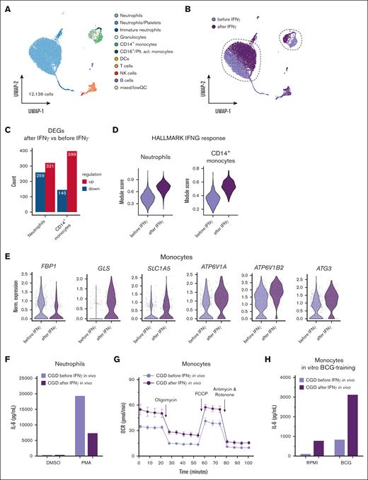 IFN-γ in vivo treatment leads to transcriptional reprogramming of cells and restores functional immunometabolic defects in monocytes from 1 patient with CGD. (A) uniform manifold approximation and projection (UMAP) visualization of 12 136 whole blood cells of 1 patient with CGD before and 4 hours after in vivo Imukine (rIFN-γ) subcutaneous treatment (50 mg/m2 body surface area, with a maximum of 100 mg) profiled with scRNA-seq and colored by cell type. (B) UMAP visualization of cells colored by condition, before (light purple) and 4 hours after (dark purple) in vivo Imukine (rIFN-γ) treatment. (C) Numbers of differentially expressed genes identified as upregulated (red) or downregulated (blue) in neutrophils and CD14+ monocytes. (D) Module score of the HALLMARK gene set “interferon gamma response” in neutrophils and CD14+ monocytes before and after rIFN-γ treatment. (E) Violin plots of selected differentially expressed genes in CD14+ monocytes isolated before and after in vivo rIFN-γ treatment. (F) IL-8 production after 4 hours of stimulation with either medium or PMA (50 ng/mL) in neutrophils from a patient with CGD before and 4 hours after receiving in vivo Imukine (rIFN-γ) subcutaneously. (G) OCR after Mito Stress Test of monocytes isolated from a patient with CGD before and 4 hours after receiving in vivo Imukine (rIFN-γ) subcutaneously. (H) IL-6 production from monocytes after LPS restimulation at day 6 after BCG-training protocol. Monocytes were isolated from 1 patient with CGD before and 4 hours after receiving Imukine (rIFN-γ). Owing to the low number of subjects, statistical analysis could not be performed for this set of experiments. DCs, dendritic cells; DMSO, dimethyl sulfoxide; NK, natural killer; Plt.act., platelet-activated; QC, quality control.
