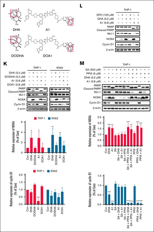 A1 reduces the cyclin D1 protein through the endoperoxide of DHA-mediated NOXA production. (A) THP-1 and K562 cells were treated with 1.6 to 3.2 μM DHA or VEN and 0.4 to 0.8 μM A1 for 24 hours. The protein levels were determined by western blotting. The right column figures are image density analyses of 3 independent experiments. (B) THP-1 and K562 cells were treated with 3.2 μM DHA and 0.8 μM A1 for the indicated times. The protein levels were detected by western blot analysis. (C) THP-1 cells were pretreated with 25 μM Q-VD-OPh for 4 hours, followed by 3.2 μM DHA and 0.8 μM A1 treatment for 24 hours. The cyclin D1 and NOXA levels were detected using western blot analysis. (D) The DNA distribution was assessed by flow cytometry after PI staining. (E) Cell growth inhibition of THP-1 cells pretreated with Q-VD-OPh, followed by A1 and DHA for 24 hours. (F) THP-1 cells were transduced with shNC or shPMAIP1 and then treated with 0.8 μM A1 for 24 hours. (G) THP-1 cells were transduced with shNC or shBCL2L11, then treated with 0.8 μM A1 for 24 hours. (H) Raji cells that were defective in NOXA were treated with 0.2 to 0.8 μM A1 for 24 hours. (I) Jeko-1 cells that were defective in Bim were treated with 0.2 to 0.8 μM A1 for 24 hours. The relative levels of the NOXA and cyclin D1 were determined by western blotting. (J) The chemical structures of DODHA and DOA1 with the reduced endoperoxide moiety of DHA and A1. (K) The protein levels of cyclin D1 and NOXA in the THP-1 and K562 cells that were treated with DHA, A1, DODHA, and DOA1 for 24 hours. The right column figures are image density analyses of 3 independent experiments. (L) The iron chelator DFO blocks A1-induced NOXA. THP-1 cells were pretreated with 100 μM DFO for 4 hours and then treated with 3.2 μM DHA and 0.8 μM A1 for 24 hours. (M) The heme synthetic precursor and inhibitor regulate A1-induced NOXA. THP-1 cells were pretreated with 250 μM SA, 5 μM PPIX, or 250 μM SA + 5 μM PPIX for 24 hours, followed by 3.2 μM DHA and 0.8 μM A1 treatment for 24 hours. The right column figures are image density analyses of 3 independent experiments. ∗P < .05; ∗∗P < .01; ∗∗∗P < .001 when compared with the control group. ##P < .01; ###P < .001 2-group analysis. BimEL, Bim extralong; BimL, Bim long; BimS, Bim short; Con, control; PPIX, protoporphyrin IX; SA, succinylacetone.