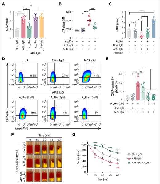 Inhibition of APS IgG–accelerated platelet activation, clot retraction, and procoagulant platelet formation by an A2AR agonist. (A) Purified platelets were pretreated with A2AR-a (5 μM) and A2BR-a (5 μM), followed by stimulation with 100 μg/mL cont IgG or APS IgG for 1 hour, and surface CD62P was assessed using flow cytometry. (B-C) Using assay kits, released ATP in supernatant and cellular cAMP were measured in platelets pretreated with A2AR-a (5 μM) followed by stimulation with 100 μg/mL of cont IgG or APS IgG for 1 hour. Forskolin (1 μM) was used as a positive cont for cAMP quantification. (D-E) Flow cytometric quantification of PS exposure along with CD62P in platelets treated with either vehicle or various concentrations of A2AR-a, followed by stimulation with 100 μg/mL cont IgG or APS IgG. (F) The representative images show the clot retraction was measured for 1 hour in platelet-rich plasma, supplemented with red blood cells, incubated with 50 μg/mL of cont IgG or APS IgG in the presence or absence of A2AR-a (5 μM) before adding thrombin (0.25 U/mL). (G) Quantified clot size over time and the values are presented as mean ± standard error of the mean (SEM). Statistical significance was determined by 2-way ANOVA with Tukey multiple comparisons tests, n = 3 individual donors per group. Data represent mean ± SD. ∗P <.05, ∗∗P < .01, ∗∗∗P < .001, ∗∗∗∗P < .0001, and ns by a 1-way ANOVA with the Tukey multiple comparisons test (n = 4).