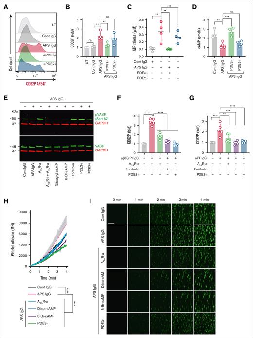 Inhibition of PDE3 ameliorates APS IgG–induced platelet activation by increasing cAMP. (A-B) Surface CD62P, (C) released ATP, and (D) cellular cAMP were measured in platelets treated with cilostazol (PDE3-i, 10 μM) and BAY 60-7550 (PDE2-i, 10 μM) before stimulation with 100 μg/mL cont IgG or APS IgG. ∗∗P < .01, ∗∗∗P < .001, and ns by a 1-way ANOVA with the Tukey multiple comparisons test (n = 4). (E) Representative immunoblots for (pVASP, Ser 157), total VASP, and GAPDH in platelets treated with A2AR-i (5μM), A2AR-a (5 μM), dibutyryl-cAMP (0.5 mM), 8-Br-cAMP (1 mM), forskolin (1 μM), PDE3-i (10 μM), or PDE2-i (10 μM) for 20 minutes, followed by stimulation with 100 μg/mL of either cont IgG or APS IgG for 1 hour (n = 3). (F-G) Flow cytometric evaluation of surface CD62P in platelets pretreated with A2AR-a (5 μM), forskolin (1 μM), or PDE3-i (10 μM), followed by stimulation with affinity-purified (F) aβ2GPI IgG (20 μg/mL) or (G) aPT IgG (10 μg/mL) for 1 hour. (H-I) Quantification and representative images of platelet adhesion and accumulation in human whole blood stained with DiOC6 and treated with 100 μg/mL cont IgG or APS IgG along with A2AR-a (5 μM), dibutyryl-cAMP (0.5 mM), 8-Br-cAMP (1 mM), PDE3-i (10 μM) perfused through a collagen-coated chamber at arterial shear (n = 5). Data represent mean ± SEM. Two-way ANOVA. Scale bars represent 100 μm. Data represent mean ± SD for panels A-G. ∗∗P < .01, ∗∗∗P < .001, and ∗∗∗∗P < .0001, by a 1-way ANOVA with the Tukey multiple comparisons test (n = 5). MFI, Mean fluorescence intensity; UT, Untreated.