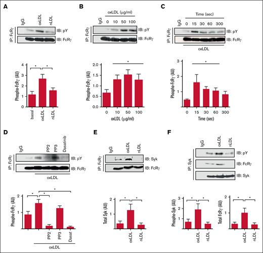 oxLDL stimulates tyrosine phosphorylation of the FcRγ. (A) Washed human platelets (7 × 108/mL) were either untreated or treated with oxLDL (50 μg/mL) or nLDL (50 μg/mL) for 15 seconds. FcRγ was immunoprecipitated from lysates and immunoblotted for phospho-tyrosine and FcRγ; representative blots (upper) and densitometric analysis (lower) of 5 independent experiments. ∗P < .05. (B) As in panel A, except platelets were stimulated with increasing concentrations of oxLDL (10-100 μg/mL). Representative blots (upper) and densitometric analysis (lower) of 5 independent experiments. ∗P < .05. (C) As in panel A, except platelets were stimulated with oxLDL (50 μg/mL) for up to 300 seconds. Representative blots (upper) and densitometric analysis (lower) of 3 independent experiments. ∗P < .05. (D) As in panel A, except platelets were treated with either PP2 (20 μM), PP3 (20 μM), or dasatinib (10 μM) for 3 minutes before stimulation with oxLDL (50 μg/L; 15 seconds). Representative blots (upper) and densitometric analysis (lower) of 4 independent experiments. ∗P < .05. (E) As in panel A, except immunoblotted for Syk and FcRγ. Representative blots (upper) and densitometric analysis (lower) of 10 independent experiments. ∗P < .05. (F) As in panel A, except Syk was immunoprecipitated and immunoblotted for phospho-tyrosine, FcRγ, and Syk. Representative blots (upper) and densitometric analysis for phospho-Syk (lower-left) and FcRγ (lower-right) of 6 independent experiments. ∗P < .05. AU, arbitrary units; IB, immunoblot; IgG, immunoglobulin G; IP, immunoprecipitate.