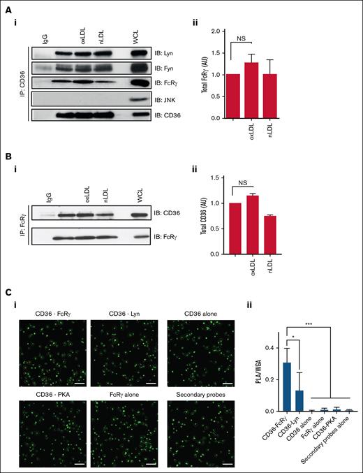 CD36 is associated with the FcRγ in human platelets. (A) Washed human platelets (7 × 108/mL), either untreated or treated with oxLDL (50 μg/mL) or nLDL (50 μg/mL) for 15 seconds, were immunoprecipitated for CD36 and immunoblotted for Fyn, Lyn, FcRγ, JNK, and CD36. (Ai) Representative blots (i) and densitometric analysis of FcRγ from 7 independent experiments (ii). (B) Washed human platelets (7 × 108/mL), either untreated or treated with oxLDL (50 μg/mL) or nLDL (50 μg/mL) for 15 seconds, were immunoprecipitated for FcRγ and immunoblotted for CD36. (i) Representative blots and (ii) densitometric analysis of CD36 from 4 independent experiments. (C) Washed human platelets (3 × 106/mL) were adhered to glass coverslips coated with oxLDL (100 μg/mL) and incubated with combinations of CD36 and FcRγ antibodies; CD36 and Lyn antibodies; CD36 and PKA RII antibodies; CD36 antibody alone; FcRγ antibody alone; or antibody diluent alone. Platelets were then stained with Alexa Fluor 488–conjugated wheat germ agglutinin to identify membranes (green) and PLA probes to detect protein-protein interactions (red). Samples were viewed using confocal microscopy under ×63 original magnification. Scale bar, 20 μm. (i) Representative overlaid images and (ii) quantification of PLA/WGA from 4 independent experiments. ∗P < .05, ∗∗∗P < .001. IgG, immunoglobulin G; NS, nonsignificant; WCL, whole-cell lysate; WGA, wheat germ agglutinin.