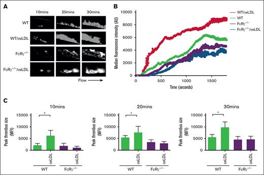 FcRγ promotes thrombosis in response to oxLDL. WT and FcRγ−/− mice were injected with oxLDL (2.5 mg per kg body weight) or phosphate-buffered saline vehicle, followed by FeCl3 (5%) injury and in vivo thrombosis assessed by intravital microscopy. (A) Representative fluorescence images of thrombi formed under different conditions are shown over the course of 30 minutes after vascular injury. Black arrow shows the direction of blood flow. (B) Representative median integrated fluorescence signals of rhodamine G obtained from an individual carotid thrombus under different conditions. (C) Quantification of median integrated fluorescence signals of peak thrombus size at 10, 20, and 30 minutes after vascular injury taken from WT and FcRγ−/− mice (n = 5) for each treatment. ∗P < .05.