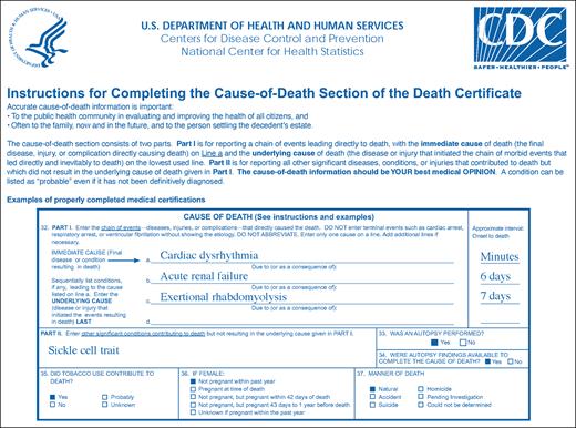 The Centers for Disease Control death certificate instructions with an example for an adult with SCT, who died of exertional rhabdomylosis temporally related to death.