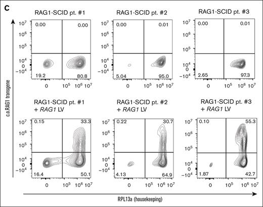 MND-c.o.RAG1 lentivirus (LV) efficiently transduces HSPCs from RAG1-SCID patients. (A) Schematic representation of the location of the RAG1 mutations in the 3 RAG1-SCID patients, including the specific mutation and the cell count of CD3, CD4, and naïve CD4 cells per microliter of blood. The N-terminal noncore domain consists of a series of basic motifs (not depicted) and a domain formed by a RING finger and zinc finger motif. The core domain consists of NBD, DDBD, PHD, preR, RNH, zinc-binding domain, and the CTD. Based on Notarangelo et al. with permission.1 (B) Experimental setup created with biorender.com. Canté-Barrett, K. (2025) https://biorender.com/gz8bj0t (C) Primeflow analysis of patient samples 1 to 3 before and after LV transduction with MND-c.o.RAG1. RPL13a: housekeeping mRNA, c.o.RAG1: codon-optimized RAG1 mRNA, as measured by flow cytometry. CTD, carboxy-terminal domain; DDBD, dimerization and DNA-binding domain; NBD, nonamer-binding domain; PHD, plant homeodomain; preR, pre-RNase H; pt, patient; RNH, catalytic RNase H.
