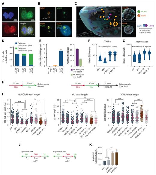 ELDR interferes with the progression of DNA replication forks. (A) Representative image of colocalization of ELDR (red) and PCNA (green) in nuclear punctate structures using smFISH for ELDR and immunofluorescence with an anti-PCNA antibody and DAPI staining (blue). Scale bars, 5 μm. (B) Representative image of colocalization of ELDR (red) and MCM5 (green) in nuclear punctate structures using smFISH for ELDR and immunofluorescence with an anti-MCM5 antibody and DAPI staining (blue). Scale bar, 10 μm. (C) Spot detection using the IMARIS software for 3D reconstructions from immunofluorescence images for MCM5 and smFISH for ELDR detection. Spots represent individual signals for MCM5 (green) or ELDR (orange), respectively, and for MCM5-ELDR complexes (blue/purple). The cutoff for colocalization was 240 nm. Scale bar, 1 μm. Controls: representative 3D reconstruction of nuclei stained with an immunoglobulin G (IgG) control antibody and with human ELDR or murine ELDR (mELDR) probes for the smFISH. (D) Quantification of the percentage of cells among all analyzed cells with MCM5-ELDR complexes (ie, colocalized MCM5-ELDR spots per cell). Cell numbers were n = 94 for mELDR + IgG control, n = 63 cells for ELDR + IgG control, n = 109 for ELDR+MCM5. (E) Among cells with ELDR-MCM5 complexes, the number of colocalized spots per cell and the percentage of MCM5 colocalized with and without ELDR were quantified. (F-G) Relative EdU intensity measured by flow cytometry in S phase cells (see gating in Figure 2E) in THP-1 ELDR-overexpressing ELDR-C1 and ELDR-C3 cell lines compared with control cell lines EV1 and EV2 or in Mono-Mac-1 ELDR-overexpressing ELDR-C4 and ELDR-C7 cell lines compared with control cell lines EV2 and EV3, cultured in HS-5 conditioned media. (H) Left panel: schema of DNA fiber assay. Labeling scheme: CIdU (red) was incorporated as the first analog, followed by IdU (green), incorporated as the second analog at indicated time points. Right panel: HU was added to completely stop fork progression for indicated time point. (I) DNA fiber assay with same incubation times (30 minutes) for IdU and CIdU labeling with or without subsequent HU treatment. Plots of IdU/CIdU ratios and IdU or CIdU track lengths for the indicated THP-1 ELDR-overexpressing cell lines (ELDR-C1, ELDR-C3) and controls (EV1, EV2). Experiments were performed in 2 to 3 biological replicates and at least 150 to 200 dually labeled fibers were measured for each condition. Only bicolor fibers were analyzed, that is, forks that progressed normally during the first labeling period. (J) Schema of symmetric and asymmetric forks. In contrary to symmetric fork progression (A/B ≈ 1), both sides (A and B) of the origin will not progress at the same rate (A/B ≠ 1) in asymmetric fork resulting in fork stalling. (K) Quantification of frequency of asymmetric DNA replication forks (in percent). Total number of forks counted: 30 to 40 per sample. n = 3 biological replicates. Data are presented as mean + SD (panels E, K); ± SD (panel I). ∗∗∗P < .001; ∗∗∗∗P < .0001. P values were calculated using Kruskal-Wallis test (panel I); 1-way ANOVA with Tukey's multiple comparisons test (K). ns, not significant; HU, hydroxyurea.