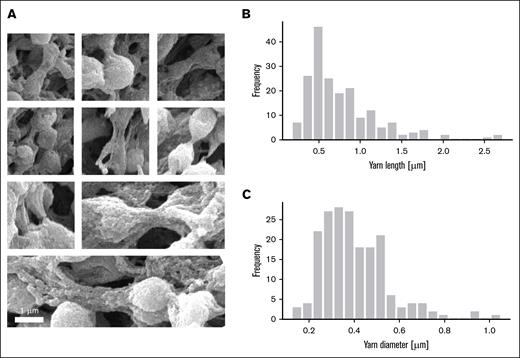 High-resolution SEM images enable measurements of the dimensions of yarns. (A) Mosaic of high-magnification SEM images showing a variety of yarns bridging adjacent platelets. (B) Distribution of measured yarn length. Average yarn length, 0.77 ± 0.44 μm (N = 191). (C) Distribution of measured yarn diameter. Average yarn diameter, 0.40 ± 0.15 μm (N = 191). Length and diameter were measured using ImageJ on SEM images.
