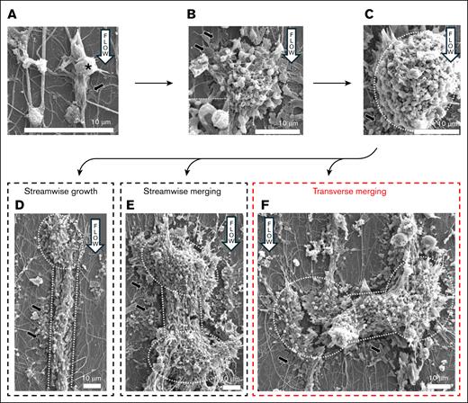 Islets downstream of the occluding cable could merge transversally. SEM images show various morphologies of aggregates spread on the collagen layer. (A) Platelet (marked with “∗”) on top of yarn oriented in the flow direction, from flow-elongated VWF immobilized on the collagen layer. (B) Aggregates of platelets forming a short, rounded islet. Most platelets appeared in a degranulated state, similar to the one shown in the dashed square, indicative of platelet α-granule release. (C) Larger rounded islet showing uniform growth of an islet. (D) Islet linked to a cable made of platelet-VWF strings (straight dashed lines), likely the result of streamwise growth induced by flow forces. (E) Two islets that merged in the streamwise direction. (F) Two islets that merged in the transverse direction, possibly representing mechanism for the transverse cable growth. Islets came in various size (longest dimension: 20-100 μm). In panels A-F, a uniform looking material (black arrows in images) was spread on the glass slide and attached to the foundation of agglomerates or islets, likely spread platelets.