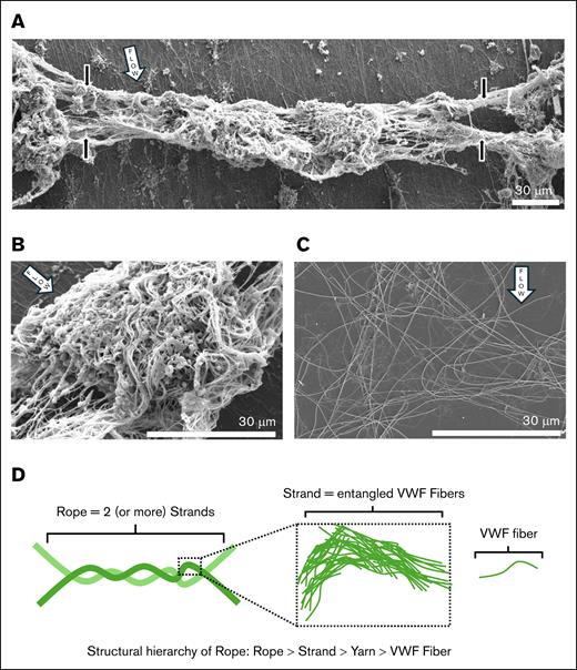A second macroscopic structure resembled a rope with few platelets made of woven strands of thinner yarns of VWF fibers. (A) Low-magnification SEM revealed that the crosscurrent mass adopted the structure of a rope made of strands of yarn (black arrows; diameter 10-15 μm) suspended above the glass slide. We surmise this rope formed in the streamwise direction at the edge of the chamber and was dislodged transversally after one side broke. (B) Higher magnification revealed a structure abundant in yarns of VWF, with few platelets compared to the occlusive transverse cable seen in Figure 4A. (C) SEM of representative example of the densest region of sheared (15 000/s; 10 minutes) collagen fibers in separate flow experiments without whole blood (n = 2). (D) Schematic of the structural hierarchy of the rope structure.