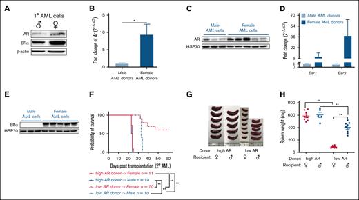 AR expression in AML cells affects survival. (A) Western blot showing the expression of ARs and ERαs in purified 1° wild-type (WT) male and female AML cells. (B) Expression of Ar as assessed by quantitative polymerase chain reaction (qPCR) in WT male and female AML cells. Data were normalized to WT male AML cells and Gapdh housekeeping gene (n = 8-10 biologic replicates). (C) Western blot showing the expression of ARs in WT male and female AML cells. Each lane represents 1 biologic replicate. (D) Expression of Esr1 and Esr2 assessed by qPCR in WT male and female AML cells. The data were normalized to WT male AML cells and Gapdh housekeeping gene (n = 3-10 biologic replicates). (E) Western blot showing the expression of ERα in WT male and female AML cells. (F) Survival curve of WT female and male recipient mice secondarily transplanted with WT high and low AR–expressing AML donor cells (n = 10-11 in each group); Log-rank tests were used to indicate significance with ∗P < .05 and ∗∗P < .01. (G) Representative image of spleens isolated from recipients in panel F at the end point. (H) Spleen weights (mg) of recipient mice in panel F at the end point. Panels B,D,H, error bars represent the mean ± standard error of the mean (SEM) of replicates. ∗P < .05; ∗∗P < .01, as determined by 1-tailed unpaired Student t test.