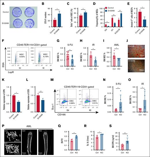 Effects of S100A8 on MSC proliferation and differentiation. (A) Representative plots of CFU-F for the S100A8 overexpression group and control group. (B) CFU-F counts in the S100A8 overexpression group and control group (n = 3). (C) The proliferation of MSCs in the S100A8 overexpression and control groups (n = 4). (D) Cell cycle status of MSCs in the S100A8 overexpression and control groups (n = 3). (E) MSC apoptosis in the S100A8 overexpression and control groups (n = 3). (F) Flow diagram of BM MSCs of S100A8-deficient and control mice. (G-I) MSC ratio in BM of S100A8-deficient and control mice after 5-FU treatment (G), IR exposure (H), and AML (I; n = 5-7). (J) Representative images of Alizarin red staining (osteogenic differentiation) of MSC in the S100A8 overexpression and control groups. (K-L) quantitative reverse transcription polymerase chain reaction analysis of osteoblastic differentiation relative genes (OPN and OCN) in MSCs from the S100A8 overexpression group and control group (n = 3). (M) A flow diagram of BM OBCs from S100A8-deficient and control mice. (N-O) OBC ratio in the BM of S100A8-deficient and control mice after 5-FU treatment (N) and IR exposure (O; n = 5-6). (P-R) Microcomputed tomography analysis of the trabecular bone in S100A8-deficient and control AML mice. Representative images are displayed in panel P (scale bars, 1 mm). (Q-R) Trabecular BT/BV and Tb. N in the femoral metaphysis are illustrated (n = 4). (S) Enzyme-linked immunosorbent assay analysis of BM protein concentrations of OPN in S100A8-deficient and control AML mice (n = 5). ∗P < .05; ∗∗P < .01; ∗∗∗P < .001. BT/BV, bone volume/total volume; Ctrl, control; KO, knockout; Tb. N, trabecular number.