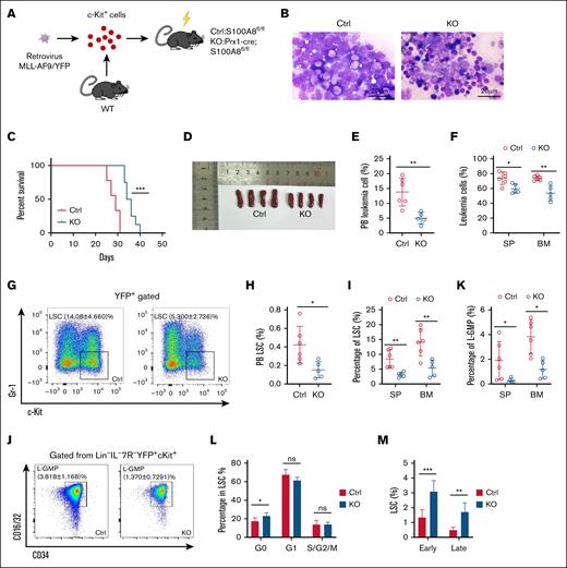 Effect of S100A8 deletion in MSCs on disease progression and LSCs in MLL-AF9 leukemic mice. (A) A flow diagram of the MLL-AF9 leukemia model, with S100A8-deficient and control mice as recipients. (B) Leukemic cell infiltration revealed by BM Wright-Giemsa staining in S100A8-deficient and control MLL-AF9 mice. (C) Survival of MLL-AF9 mice in the S100A8-deficient and control groups (n = 8-9). (D) SP size of MLL-AF9 mice in the S100A8-deficient and control groups (n = 4). (E) The proportion of PB leukemia cells in S100A8-deficient and control MLL-AF9 mice (n = 5-6). (F) The proportion of SP and BM leukemia cells in S100A8-deficient and control MLL-AF9 mice (n = 5-7). (G) A flow representation of BM LSCs (YFP+c-Kit+Gr-1–) in MLL-AF9 mice. (H) The proportion of PB LSCs in S100A8-deficient and control MLL-AF9 mice (n = 5-6). (I) Proportion of SP and BM LSCs in S100A8-deficient and control MLL-AF9 mice (n = 5-7). (J) Flow representation of BM L-GMPs (IL-7R/Lin–YFP+c-KithiCD34+CD16/32hi) in MLL-AF9 mice. (K) Proportion of L-GMPs of SP and BM of S100A8-deficient vs control MLL-AF9 mice (n = 5-7). (L) Cell cycle of BM LSCs in S100A8-deficient and control MLL-AF9 mice (n = 5-6). (M) Apoptosis of BM LSCs in S100A8-deficient and control MLL-AF9 mice (n = 6). ∗P < .05; ∗∗P < .01; ∗∗∗P < .001. Ctrl,control; KO, knockout; WT, wild-type.