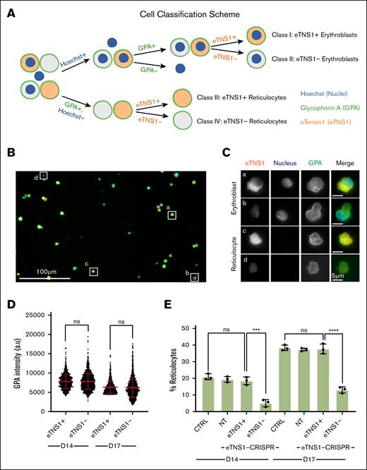 Single-cell analysis reveals loss of eTNS1 impairs erythroblast enucleation. (A) Schematic of erythroblast classification from eTNS1-KO erythroid cultures into 4 categories based on Hoechst (nuclei; blue), GPA (green), and eTNS1 (orange) staining. Cells were classified as eTNS1+ erythroblasts, eTNS1− erythroblasts, eTNS1+ reticulocytes, and eTNS1− reticulocytes. Figure created with Biorender.com. (Diaz, D. 2025, https://app.biorender.com/illustrations/655d7217e036ccb922863c17). (B) Representative single tiled image showing the heterogeneous cell population from an eTNS1 CRISPR KO culture using the Zeiss CD7. Scale bar, 100 μm. (C) Representative higher magnification images of individual cells in panel A depicting the 4 classes: (a) eTNS1+ erythroblast, (b) eTNS1− erythroblast, (c) eTNS1+ reticulocyte, and (d) eTNS1− reticulocyte. Scale bar, 5 μm. (D) Quantification of GPA intensity levels of eTNS1+ and eTNS1− cells from day-14 and day-17 eTNS1-KO cultures; 3 to 5 tiled images were taken from a single coverslip for each culture. Plot reflects the mean ± SD of 1500 eTNS1+ and eTNS1− erythroblasts from 3 independent eTNS1-KO cultures. (E) Quantification of eTNS1− and eTNS1+ reticulocytes in control, nontarget, and KO day-14 and day-17 cultures. Percentage reticulocytes calculated by dividing the number of reticulocytes by (the number of reticulocytes plus the number of erythroblasts). Plot reflects mean ± SD of percentage reticulocytes calculated from ∼6000 cells for each experiment. Three independent experiments performed for each condition. ∗∗∗P = .0002; ∗∗∗∗P < .0001. ns, non-significant. Schematic in panel A created with BioRender.com.