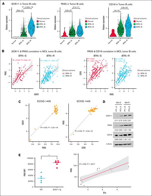 SOX11-PAX5-CD19 axis correlates with BTKi resistance in MCL. (A) Violin plot showing the relative expression levels of SOX11, PAX5, and CD19 in normal, BTKi-S, and BTKi-R MCL cell samples from the patients. Each dot represents an individual tumor B cell, with colors indicating clinical outcomes. (B) Scatter plot illustrates the correlation between SOX11 and PAX5 (left) and PAX5 and CD19 (right) in BTKi-S and BTKi-R MCL tumor B cells, respectively. A fitted line with 95% confidence intervals is shown. The correlation coefficient and P value are indicated on each plot. (C) SOX11, PAX5, and CD19 mRNA expression are positive correlates in patients’ tumor cells (n = 39, ECOG 1405 data sheets). (D) Immunoblot analysis showing the expression of SOX11, PAX5, and CD19 in primary cells from IBN-sensitive and IBN-resistant patients. β-Actin was used as a loading and transfer control. (E) Increased levels of PAX5 were observed in CD5+, CD19+, and CD23– (B1a) PB mononuclear cells from Tg-SOX11 mice (n = 6) in comparison to WT mice (n = 5) controls. ∗∗, P < .001. ECOG, Eastern Cooperative Oncology Group.