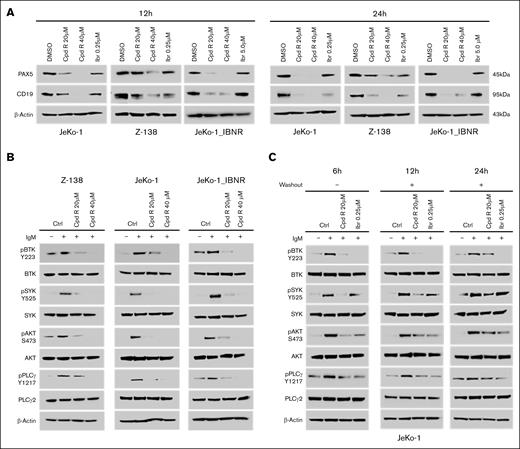 SOX11i (Cpd R) treatment reduced the PAX5 and CD19 protein expression and attenuated downstream BCR signaling in MCL. (A) JeKo-1, JeKo-1_IBN-R, and Z-138 cells were incubated with Cpd R for 12 and 24 hours and IBN at indicated concentrations, after which PAX5 and CD19 were monitored by immunoblotting analysis. (B) JeKo-1, JeKo-1_IBN-R, and Z138 cells were treated for 12 hours and then stimulated with 5 μg/mL of IgM for 10 minutes. Whole-cell lysates were analyzed using immunoblotting. (C) JeKo-1 cells were treated for 6 hours with Cpd R (20 μM) and IBN (0.25 μM), followed by washing, transfer to fresh medium, and collection at the indicated time points. Immunoblotting analysis was then performed. β-Actin was assayed to ensure equivalent loading and transfer. Ctrl, DMSO Control.