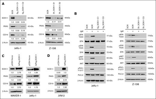 Genetic depletion of SOX11 reduced the expression of PAX5 and CD19. (A) CRISPR/Cas9- and short hairpin RNA (shRNA)-mediated knockdown of SOX11 resulted in reduced protein levels of PAX5 and CD19 in JeKo-1 and Z-138 cells. SCR refers to the scramble control; sg_SOX11 indicates guide RNAs C1 and C2; sh_SOX11 represents shRNA constructs C1 and C2, respectively. (B) Genetic knockdown of SOX11 led to reduced phosphorylation of downstream BCR signaling components. SOX11-deficient cells were stimulated with 5 μg/mL of IgM for 10 minutes, followed by immunoblot analysis of whole-cell lysates. (C) Overexpression of SOX11, tagged with 3XFlag, induces elevated levels of PAX5 and CD19 expression in the MAVER-1 and JeKo-1 cell lines. (D) Ectopic expression of SOX11 resulted in an increased level of PAX5 and CD19 in the SOX11-negative cell line JVM-2. Immunoblot experiments were performed to validate the results, and β-actin was used as a loading control to ensure equivalent loading and transfer. SCR, scramble control; sg_SOX11, guide RNAs C1 and C2; sh_SOX11, shRNA constructs C1 and C2.
