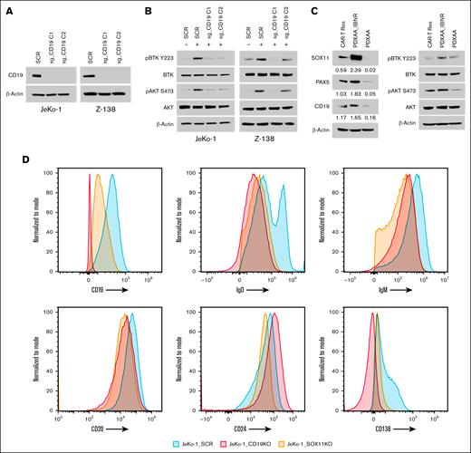 CD19 regulates BCR signaling in a SOX11-dependent manner. (A) CRISPR/Cas9-mediated genetic depletion of CD19 decreased CD19 protein expression in JeKo-1 and Z-138 cells, along with (B) a reduction in the phosphorylation of BTK and AKT. Immunoblot experiments were performed to validate the results, whereas β-actin was assayed to ensure equivalent loading and transfer. (C) Immunoblot experiments were performed in PDX cells, with results indicating that high SOX11 expression leads to an increase in CD19 levels, leading to enhanced downstream BCR signaling. (D) Histograms depict the expression of B-cell and plasma cell surface markers (CD19, CD20, CD24, and CD138), as well as surface IgD and IgM, as measured by flow cytometry in SOX11 and CD19 knockout JeKo-1 cell lines, compared to that in the WT mice. CAR-T Res, CAR-T resistance; SCR, scramble control.