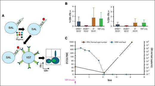 Representative example of using HLA restriction data derived from SALs to aid in VST selection. (A) Schematic representation of the SAL assay. (B) Bar graphs representing the CD8+IFN-γ+ and CD4+IFN-γ+ cell populations by intracellular flow cytometry after the completion of the SAL assay. These data are for product 2777-437B, which was then given to patient 414. The VST only column indicates VST products cocultured with Pepmix rather than cocultured with Pepmix-loaded SALs. (C) ELISpot data from patient 414 showing increase in EBV-directed T cells in the peripheral blood with a concurrent decrease in viral load.