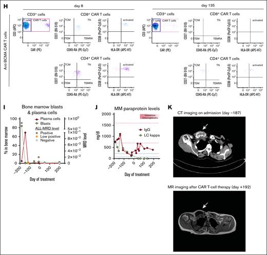 Clinical course after dual CAR T-cell therapy. (A) Timeline of treatment and CAR T-cell therapy–related adverse events and management. (B) Laboratory parameters supporting the diagnosis of IEC-HS. (C) Time-course analysis of inflammatory markers, sIL2R and ferritin, in the PB. (D) Time-course analysis of LDH and fibrinogen in the PB. (E) Time-course analysis of treatment-related hematotoxicity affecting neutrophil and platelet counts. (F) Time-course analysis of CAR T-cell expansion in the PB. (G-H) Flow cytometry–based phenotyping of CAR T cells in the PB for CD19/22 CAR T cells (G) and BCMA CAR T cells at early and late time points (H). (I) Time-course analysis of BM blasts and plasma cells, as well as ALL-MRD levels (low positive indicates MRD positive below quantifiable threshold). (J) Time-course analysis of MM paraprotein levels. (K) Imaging studies of right clavicle MM lesion with paramedullary involvement on admission (CT scan, upper) and ∼7 months after CAR T-cell therapy (MR imaging, lower). ANC, absolute neutrophil count; CRS, cytokine release syndrome; CT, computed tomography; G-CSF, granulocyte-macrophage colony-stimulating factor; GPT, glutamate-pyruvate transaminase; γ-GT; gamma-glutamyl transferase; ICAHT, immune effector cell–associated hematotoxicity; ICANS, immune effector cell-associated neurotoxicity syndrome; IEC-HS, immune effector cell–associated hemophagocytic lymphohistiocytosis–like syndrome; IgG, immunoglobulin G; LC, light chain; LD, lymphodepletion; LDH, lactate dehydrogenase; MR, magnetic resonance; PE-Cy7, phycoerythrin-cyanine7; PLT, platelets; sIL-2R, soluble interleukin-2 receptor; TCM, central memory T cells; TEM, effector memory T cells; TEMRA, effector memory CD45RA T cells; TN, naïve T cells.