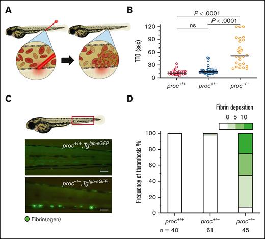 proc mutants develop spontaneous thrombosis with secondary coagulopathy. (A) Schematic of laser-mediated endothelial injury that was performed to evaluate for intravascular thrombus formation. The laser injures the endothelium of the PCV, and TTO was measured for up to 2 minutes. (B) Homozygous proc mutants demonstrated a partial defect in hemostasis manifested by a significant prolonged TTO compared to wild-type and heterozygous siblings. n = 26, 41, 26 in proc+/+, proc+/−, and proc−/−, respectively. Bars indicate median TTO. Values of P were calculated by Mann-Whitney U test. (C) The proc mutation was bred into the Tgfgb-eGFP transgenic background so that spontaneous thrombosis could be visually observed and scored through green fluorescence. A representative image of spontaneous PCV thrombosis in proc−/− larvae, which was not observed in wild-type and heterozygous siblings. Scale bar 100 μm. (D) Quantification by a blinded observer demonstrated significant spontaneous thrombosis only in the homozygous proc mutants. P <.0001 for comparison of both wild-type and homozygous siblings, and between heterozygous and homozygous siblings (Fishers exact test). The fibrin deposition scale indicates the number of thrombi counted in each larva, binned into 4 groups. ns, not significant.
