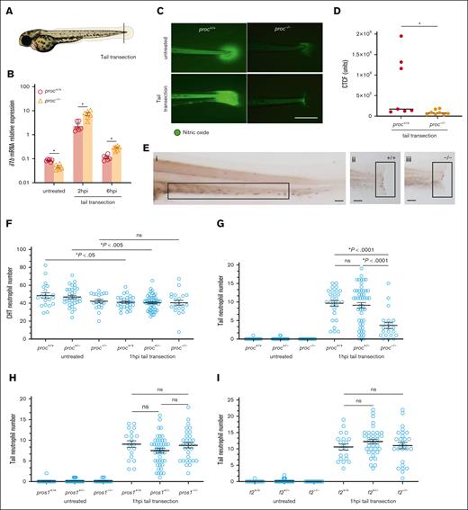 PC plays a role in inflammation and neutrophil migration after tail transection. (A) Tail transection injury distal to the notochord and vasculature was performed to induce injury-triggered inflammation at 3 dpf. (B) qPCR of total cDNA before and after transection revealed upregulation of il1b mRNA in both wild-type and proc−/− mutants but was more pronounced for the latter; n = 6 in each group. ∗P < .001 by t test (C) DAF-FM diacetate staining revealed that nitric oxide accumulation after injury was absent in proc−/− fish. Scale bar, 500 μm. All studies were performed by an observer blinded to genotype and treatment. (D) Fluorescence quantification using CTCF demonstrated a significant decrease of nitric oxide in injured proc−/− compared to injured wild-type (t test P < .05, n = 7-8 for each group). (E) Sudan Black staining revealed neutrophils in caudal hematopoietic tissue (CHT), boxed area (i), as well as at the tail transection site, boxed areas (ii-iii). Representative images demonstrate less neutrophils at the tail transection site in proc−/− in panel Eiii in comparison with wild-type siblings in panel Eii. Scale bar, 100 μm. (F) The unchanged neutrophil CHT counts reveal that proc mutation does not affect the production of neutrophils prior to injury (P = .09). Significant reduction of neutrophil numbers in CHT were observed 1 hour after tail transection in wild-type and heterozygous larvae, suggesting neutrophil migration in response to injury. No such change was detected in the proc homozygous group. (G) The absence of PC results in a reduction in neutrophil recruitment. (H) Loss of PS does not affect neutrophil recruitment. (I) Prothrombin (f2) deficiency does not affect neutrophil migration upon tail transection. P values were calculated by unpaired t test. All studies were performed by an observer blinded to genotype and treatment. DAF-FM, diaminofluorescein-FM; CTCF, corrected total cell fluorescence; hpi, hour post injury; ns, not significant.