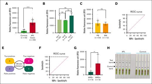 Validation of RAPID-CRISPR assay using clinical samples. (A) Measurement of fluorescence using isoform-specific crRNA in APL cases (n = 66) and controls (n = 43) by RAPID-CRISPR. The result is represented as a median with an interquartile range; P < .0001. (B) Fluorescence data of bcr1, bcr2, and bcr3 isoforms of PML::RARA by RAPID-CRISPR. A median with an interquartile range represents the data P = ns (nonsignificant). (C) Fluorescence data of APL cases from the PB (n = 54) and BM (n = 12). The data are represented as a median with interquartile range; P = ns. (D) ROC curve to estimate the clinical sensitivity and specificity of the RAPID-CRISPR assay with APL (n = 66) and control (n = 43) cases. Area under the curve (AUC) = 1.000; 95% confidence interval (CI), 1.000-1.000. (E) Illustration of blinded validation of RAPID-CRISPR in APL (n = 9) and control (n = 9) cases. (F) ROC curve to estimate the clinical sensitivity and specificity of the RAPID-CRISPR assay in a blinded validation experiment. AUC = 1.000; 95% CI, 1.000-1.000. (G) Measurement of fluorescence between MRD− (n = 6) and MRD+ (n = 6) APL cases by RAPID-CRISPR assay. The data are represented as a median with interquartile range; P < .01. (H) LF-based readouts of RAPID-CRISPR assay for PML::RARA detection using 5 APL cases and 5 controls.