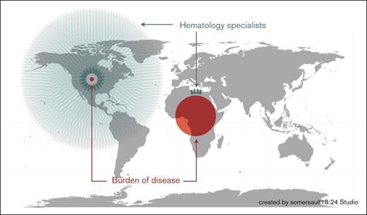 Geospatial map of the burden of disease and number of hematology specialists. This figure depicts the geographical disparities of hematologic conditions vs hematology specialists in the United States compared with sub-Saharan Africa, highlighting the need for many more trained subspecialists to provide care for the greater burden of hematology disease among children in Africa.
