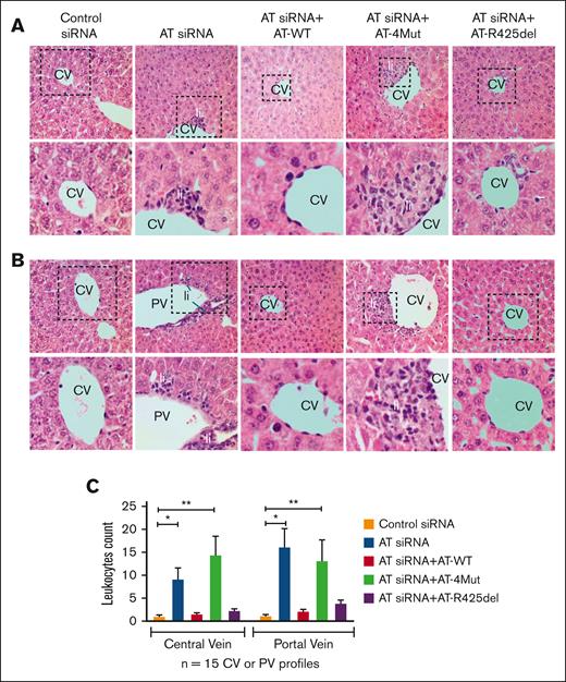 Analysis of liver histology. (A-B) Mice were treated with control siRNA, AT siRNA, AT siRNA + AT-WT, AT siRNA+AT-4Mut, or AT siRNA+AT-R425del as described in “Methods.” After 72 hours of siRNA treatment, mice were euthanized followed by perfusion with phosphate-buffered saline (PBS). Different organs were freshly collected and fixed with 10% neutral buffered formalin. The right lobe of the liver was collected and processed for histological analysis. Paraffin-embedded sections of the liver tissue were stained with hematoxylin and eosin and histopathological analysis was performed. Changes in the liver cytoarchitecture in animals treated with AT siRNA, with or without supplementation with AT-WT, AT-4Mut, or AT-R425del, were analyzed. Control siRNA–treated mice were used as controls. AT gene silencing (AT siRNA) leads to inflammation, characterized by leukocytic infiltration (Li) in areas surrounding the central veins (CV) or portal veins (PV). Inset boxes from each group are magnified. (C) Quantitation of leukocytes infiltration in areas surrounding the CV and PV. n ≥ 3. Scale bar, 50 μm.