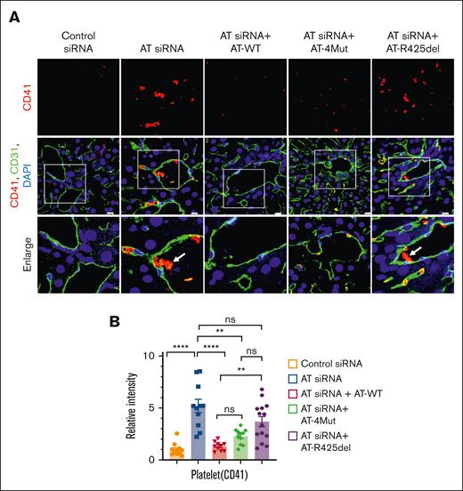 Characterization of the prothrombotic phenotype of AT-deficient and AT-infused mice. Mice were treated with control siRNA and AT siRNA, followed by infusion of saline, AT-WT, AT-4Mut, or AT-R425del at 24 and 48 hours of siRNA treatment. Mice were euthanized after 72 hours of siRNA treatment and perfused with PBS. (A) Perfused liver cryosections were fixed, permeabilized, and incubated with anti-CD41 (rat; platelet marker) and anti-CD31 (goat) antibodies followed by Alexa Fluor 562–conjugated and anti-rat Alexa Fluor 488–conjugated anti-goat antibodies. DAPI was used to stain the nucleus. The arrows indicate platelet-rich thrombus. Inset boxes from each group are magnified. Scale bar, 50 μm. (B) Relative MFI of CD-41 staining is presented. All data are presented as mean ± SEM. n ≥ 3. Statistical analysis was performed using Graph Pad Prism 10. P values are determined by 1-way ANOVA, followed by Bonferroni multiple comparison test. ∗∗P < .01; ∗∗∗∗P ≤ .0001. ns, not significant.