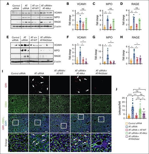 Western blot analysis of signaling molecules and infiltration of GR1-positive leukocyte to the liver tissues. Mice were treated with control siRNA and AT siRNA, followed by infusion of saline, AT-WT, AT-4Mut, or AT-R425del at 24 and 48 hours of siRNA treatment. Mice were euthanized after 72 hours of siRNA treatment and perfused with PBS. (A) The perfused left lobe of the liver was harvested in the tissue lysis buffer and immunoblotted for VCAM1, myeloperoxidase (MPO), and RAGE. β-actin was used as a loading control. (B-D) Densitometric analysis of VCAM1, MPO, and RAGE expression in liver tissue samples. (E) The perfused left lobe of the liver was harvested in the tissue lysis buffer and immunoblotted for VCAM1, MPO, and RAGE expression in liver tissue samples. β-actin was used as a loading control. (F-H) Densitometric analysis of VCAM1, MPO, and RAGE in liver tissue samples. (I-J) Mice were treated with control siRNA or AT siRNA followed by infusion of saline, AT-WT, AT-4Mut, or AT-R425del at 24 and 48 hours of siRNA treatment. (I) Perfused liver cryosections were fixed, permeabilized, and incubated with anti-GR1 (rat) and anti-CD31 (goat) antibodies followed by Alexa Fluor 555–conjugated anti-rabbit and Alexa Fluor 488–conjugated anti-goat antibodies. DAPI was used to stain the nucleus. Inset boxes from each group are magnified. Scale bar, 50 μm. (J) Number of GR1-positive leukocytes per field is presented. All data are presented as mean ± SEM. n ≥ 4. Statistical analysis was performed using Graph Pad Prism 10. P values are determined by 1-way ANOVA, followed by Bonferroni multiple comparison test. ∗P < .05; ∗∗P < .01; ∗∗∗P ≤ .001. ns, not significant.