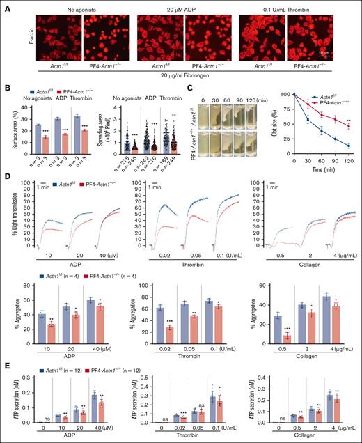 α-Actinin-1 deficiency reduces platelet function, including platelet spreading, clot retraction, aggregation, and ATP secretion. (A) Platelets from Actn1f/f and PF4-Actn1−/− mice were allowed to adhere to, and spread on, fibrinogen-coated coverslips for 90 minutes without or with ADP (20 μmol/L) or thrombin (0.1 U/mL) and then stained with tetramethyl rhodamine isothiocyanate-labeled phalloidin. The data shown are representative pictures from 1 of 3 experiments with similar results. The scale bar is 10 μm. (B) The left panel shows the percentage of the surface area covered by spreading platelets. The right panel displays the surface coverage area of each platelet (n = 3 independent experiments). (C) The clots were photographed at different time points. The percentage of the clot size was generated by calculating the ratio of the surface area of the retracted clots to that of the initial clots (n = 3 independent experiments). The data are presented as the mean and SD of 3 independent experiments. (D) Platelet-rich plasma or washed platelets from Actn1f/f and PF4-Actn1−/− mice were stimulated with ADP (10, 20, and 40 μmol/L), thrombin (0.02, 0.05, and 0.1 U/mL), and collagen (0.5, 2, and 4 μg/mL). The results are expressed as the percent change in light transmission relative to the blank (platelet poor plasma/buffer without platelets), set at 100% (n = 4 independent experiments). (E) ATP secretion from dense granules in platelets stimulated with agonists, including ADP (0, 10, 20, and 40 μmol/L), thrombin (0, 0.02, 0.05, and 0.1 U/mL), and collagen (0, 0.5, 2, and 4 μg/mL). The data are shown as the mean ± SD (n = 12 mice per group). ∗P < .05; ∗∗P < .01; ∗∗∗P < .005. ns, not significant.