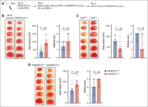 Preceding RTI caused by SARS-CoV-2 worsened stroke outcomes, alleviated by VWF deficiency and aggravated by ADAMTS13 deficiency. (A) Schematic of experimental design. (B-D) Left: representative 2,3,5-Triphenyltetrazolium chloride (TTC)-stained coronal brain sections after 45 minutes of ischemia followed by 23 hours of reperfusion (n = 7-10 mice per group). The white area indicates an infarct. Middle: infract volume quantification. Right: neurological Bederson score of the same mouse groups on day 1 after reperfusion (n = 7-10 mice per group). Data are presented as mean ± SEM (middle) or median and range (right). Statistical analysis was performed with an unpaired t test for panels B-C (middle) or Mann-Whitney U test (right).