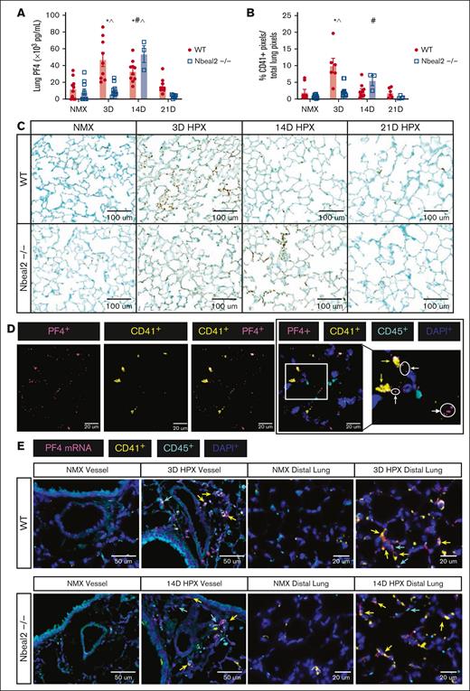 Hypoxia-induced increase in lung PF4 and accumulation of lung platelets was delayed in Nbeal2−/− mice. (A) Lung PF4 increased in hypoxic WT mice at days 3 and 14. Lung PF4 increased in hypoxic Nbeal2−/− mice at day 14. Hypoxia-induced increase in lung PF4 was decreased at day 3 and increased at day 14 in Nbeal2−/− compared with WT mice. (B) Platelets accumulated in the distal lung of hypoxic WT mice at day 3, which resolved by day 21. Accumulation of distal lung platelets was not observed in hypoxic Nbeal2−/− mice. (C) Whole-slide scans were obtained using the Leica Aperio VERSA brightfield scope (×40 objective, 0.5-micron resolution). Representative images of CD41 staining in the distal lung (original magnification ×20; scale bars, 100 μm. As previously described, CD41+ pixels were quantified in whole-lung sections using a random, nonbiased approach using ImageScope, version 12.4.3.500 (Leica Biosystems Imaging, Inc, Deer Park, IL) pixel quantification software.1 (D) Lung sections were stained with anti-PF4, anti-CD41, anti-CD45, and DAPI. Whole-slide scans were obtained using the 3I Marianas Confocal Microscope (×100 objective, 0.1-micron resolution). Representative images of intracellular and extracellular PF4 were captured. Original magnification ×100; scale bars, 50 μm. White arrows indicate extracellular PF4 (magenta), and yellow arrows indicate intracellular PF4 within platelets (yellow). (E) Lung sections were probed with a PF4 mRNA primer and anti-CD41, anti-CD45, and DAPI antibodies. Whole-slide scans were obtained using (×40 objective, 0.5-micron resolution). Representative images of pulmonary vessels and the distal lung were captured. Representative images of peak Pf4 mRNA expression within megakaryocytes and leukocytes in the pulmonary vessels and distal lung of WT (day 3) and Nbeal2−/− (day 14) vs their baseline, as well as other unidentified cells (original magnification ×40; scale bars, 50 μm). Yellow arrows indicate PF4 mRNA (magenta) within megakaryocytes (yellow), and blue arrows indicate Pf4 mRNA within leukocytes (cyan). Statistics: P ≤.05 by 2-way ANOVA with Tukey post hoc analysis. Comparisons: (∗) WT compared with WT baseline, (#) Nbeal2−/− compared with Nbeal2−/− baseline, (^) WT compared with Nbeal2−/−. HPX, hypoxia; NMX, normoxia.