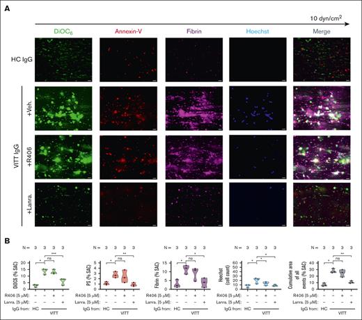 WB SYK inhibition prevents from VITT Ab–mediated multicellular thrombus formation ex vivo. (A-B) Whole blood from healthy individuals was incubated with IgG from HCs or patients with VITT in the presence of exogenous PF4 (10 μg/mL) and SYK inhibitors R406 or lanraplenib (both 5 μM) or vehicle control before recalcification and perfusion through microfluidic channels at a venous shear rate of 250 sec–1 (10 dyne/cm2) for 25 minutes. (A) After perfusion, images were acquired at magnification ×40. Scale bar, 20 μm. (B) Violin plots showing the percentage of total surface area coverage (% SAC) by DiOC6 (nonprocoagulant PLTs), annexin-V (procoagulant PS), fibrin, count of Hoechst-positive–labeled cells (leukocytes); and cumulative total % SAC with DiOC6, PS, and fibrin–labeled thrombus captured in the microfluidic channel. The number of patients tested is reported in each graph. Unpaired or paired t test is shown. ∗P < .05; ∗∗P < .01; ∗∗∗P < .001. N, number of patients tested; ns, nonsignificant.