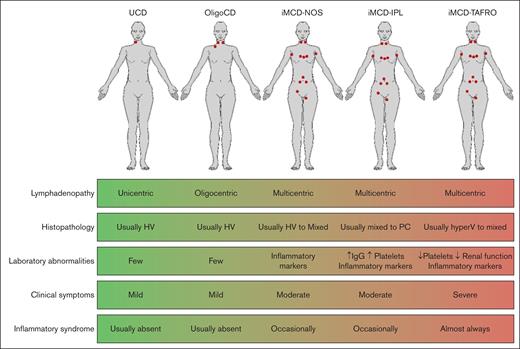 A summary of common clinical, laboratory, and histopathological features on the spectrum of patients with UCD to those with OligoCD and with iMCD. Patients demonstrate differences in lymphadenopathy, histopathology, laboratory and clinical abnormalities, and degree of inflammation. The patients with the least severe disease typically have UCD, and the most severe cases are typically iMCD-TAFRO. Severity of symptoms along this spectrum should be considered when making a diagnosis. HV, hyaline vascular; hyperV, hypervascular; PC, plasmacytic.