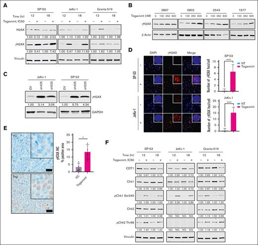 Targeting TBL1X induces DNA damage in MCL cells. (A) Immunoblot analyses of MCL cell lines (JeKo-1, SP-53, and Granta-519) treated with tegavivint (IC50, 12-18 hours) compared with dimethyl sulfoxide (DMSO) control for quantification of γH2AX formation (Ser-139 phosphorylation). Immunoblot analyses for γH2AX formation in (B) tegavivint-treated (18-hour, 0-100 nM) primary MCL patient samples (n = 4) and (C) MCL cell lines (n = 2) subjected to TBL1X shRNA KD with specific constructs (n = 2; sh425 and sh525) or EV control. (D) Immunofluorescence for γH2AX (red) foci with quantification (number of γH2AX per cell) in tegavivint-treated (IC50, 12 hour) MCL cell lines (n = 2) compared with DMSO control; nuclei are stained with DAPI (blue). Photomicrographs were taken at original magnification ×200 or ×600 (inset). (E) γH2AX immunohistochemistry with quantification (digital analysis for positive pixels) in the tumors of a subset of mice from the FC-muMCL1 study (Figure 2D) euthanized at a predetermined time point (day 14 after engraftment, after n = 4 tegavivint treatments). Brown chromogen (3,3'-diaminobenzidine or DAB) indicates positive γH2AX immunostaining; nuclei were counterstained blue-purple with Harris hematoxylin. Photomicrographs were taken at original magnification ×600; black scale bars, 20 μm. (F) Immunoblot analyses of MCL cell lines (JeKo-1, SP-53, and Granta-519) treated with tegavivint (IC50, 12-18 hours) compared with DMSO control for quantification of DDR Chk1 and Chk2 kinase activation (phosphorylation) and CDT1 levels. Tegavivint IC50 concentrations = 95 nM for JeKo-1, 65 nM for SP-53, and 200 nM for Granta-519. DAPI, 4′,6-diamidino-2-phenylindole; GAPDH, glyceraldehyde-3-phosphate dehydrogenase; hr, hour; NT, no treatment; NQ, not quantifiable. ∗P < .05; ∗∗P < .01; ∗∗∗P < .001; ∗∗∗∗P < .0001.