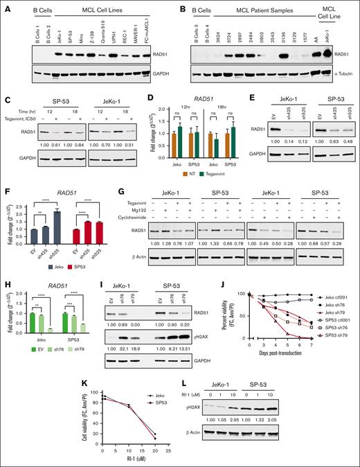 Targeting TBL1X results in the degradation of RAD51, DNA damage, and MCL cell death. Immunoblot analyses for RAD51 protein expression in (A) MCL cell lines (n = 9) and (B) primary MCL patient samples (n = 10) as compared with normal B cells. RAD51 protein levels by immunoblot and RAD51 transcript levels by qPCR in MCL cell lines (n = 2) (C-D) treated with tegavivint (IC50, 12-18 hours) vs DMSO control or (E-F) subjected to TBL1X KD with specific constructs (n = 2; sh425 and sh525) vs EV control. (G) RAD51 protein levels in MCL cell lines (n = 2) treated with proteasome inhibitor Mg132 or translation inhibitor cycloheximide combined with tegavivint compared with tegavivint-only treated cells. Cells were first treated with tegavivint (IC50), then MG132 (10 μM) or cycloheximide (10 μg/mL) was added for the last 1.5 or 3 hours, respectively, for a total incubation time of 18 hours. RAD51 shRNA KD in MCL cell lines (n = 2) with specific constructs (sh77 and sh79) compared with an EV control: (H) RAD51 transcript levels by qPCR, (I) RAD51/γH2AX protein levels by immunoblot, and (J) cell viability. (K) Cell viability and (L) γH2AX levels by immunoblot in MCL cell lines (n = 2) with targeting RAD51 pharmacologically with small molecule inhibitor RI-1 (72-hour incubation). Cell viability was determined for all experiments by annexin-V/PI staining and flow cytometry. Tegavivint IC50 concentrations = 95 nM for JeKo-1 and 65 nM for SP-53. Ann, annexin-V; GAPDH, glyceraldehyde-3-phosphate dehydrogenase; hr, hour; ns, not significant; NT, no treatment; FC, flow cytometry; PI, propidium iodide; qPCR, quantitative polymerase chain reaction. ∗P < .05; ∗∗P < .01; ∗∗∗P < .001; ∗∗∗∗P < .0001.