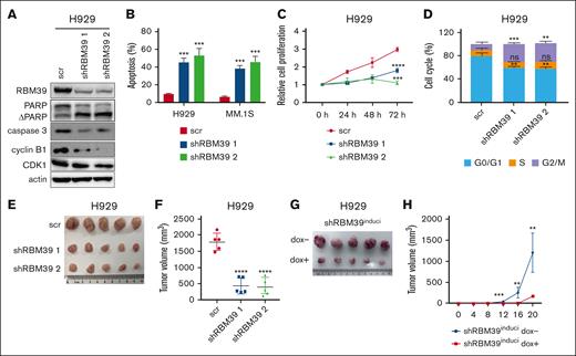 RBM39 is required for MM cell survival and tumor growth. (A) Knockdown of RBM39 in H929 cells was verified, and the modulation of apoptotic and cell cycle related proteins in RBM39-silenced H929 cells was detected by western blotting. (B) Knockdown of RBM39 induced apoptosis in H929 and MM.1S cells. Apoptosis was detected by annexin V/PI 48 hours after infection. (C) Knockdown of RBM39 inhibited the proliferation of H929. Cell viability was detected using CCK-8 at the indicated time points and the growth curve was calculated. (D) Knockdown of RBM39 induced cell cycle of H929 arrest at the G2/M phase, which was detected 48 hours after infection. (E) Images of subcutaneous tumor tissues of H929-shRBM39 cells. RBM39-knockdown H929 cells were subcutaneously inoculated into the hind flank of 6-week-old female NOG mice. The mice were euthanized 5 weeks after inoculation. (F) Tumor volume of subcutaneous tumors in panel E after mice sacrificed. (G) Images of subcutaneous tumor tissue with U266-inducible RBM39-knockdown cells. U266 cells with dox-inducible shRBM39 2 were subcutaneously inoculated into the hind flank of 6-week-old female NOG mice. The mice were euthanized 20 days after inoculation. dox− group: mice were treated with 5% sugar in water. dox+ group: mice were treated with 5% sugar plus 2 mg/mL dox. (H) Tumor sizes were measured every 4 days. ∗∗P < .01, ∗∗∗P < .001, ∗∗∗∗P < .0001. CCK-8, Cell Counting Kit-8; ns, no significant; PI, propidium iodide; scr, scrambled.
