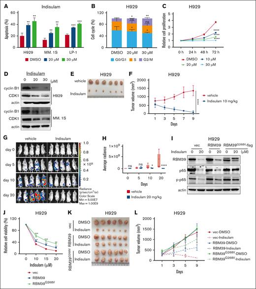 Indisulam is potent against MM in vitro and in vivo by selectively degrading RBM39. (A) Indisulam induced apoptosis in MM.1S, H929, and LP-1 cells. Apoptosis was detected after 48 hours of indisulam treatment. (B) Indisulam induced H929 cells cell cycle arrest at G2/M phase. Cell cycle was detected after 48 hours of indisulam treatment. (C) Indisulam inhibited H929 cell proliferation in a dose- and time-dependent manner. (D) The cyclin B1-CDK1 complex at the G2/M checkpoint was decreased after indisulam treatment. (E) Image of subcutaneous H929 tumor tissues treated with indisulam. H929 cells were injected into BALB/c nude mice to form subcutaneous tumors. The mice received 9 consecutive daily treatments with either vehicle or 10 mg/kg indisulam via intraperitoneal administration. (F) H929 tumors growth curve in panel E. (G) Bioluminescence images of mice transplanted with luciferase-labeled LP-1 (LP-1-luc) cells treated with vehicle or indisulam. LP-1-luc cells were injected into the tail vein of NOG mice. Five weeks after injection, the mice received 20 consecutive daily treatments of either vehicle or 20 mg/kg indisulam by intraperitoneal administration. Bioluminescence was detected at the indicated time points. (H) Quantification of bioluminescence imaging in vehicle- or indisulam-treated mice in panel G. (I) H929 cells overexpressing RBM39 or RBM39G268V were treated with 20 μM indisulam for 48 hours followed by western blot analysis to detect the expression of RBM39, p65, and p-p65. (J) Dose-response curve of cell viability assay for H929 cells overexpressed RBM39 or RBM39G268V mutant. (K) Image of H929 xenografts with RBM39 or RBM39G268V overexpressing that were treated with indisulam (10 mg/kg) for 9 consecutive days. (L) H929 tumors growth curve in panel K. ∗P < .05, ∗∗P < .01, ∗∗∗P < .001, ∗∗∗∗P < .0001). vec, vector.