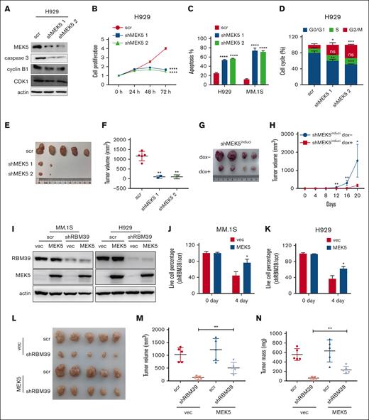 Full-length MEK5 contributes to enhanced proliferation and survival of MM cells. (A) Full-length MEK5 was knocked down in H929 cells. Expression of caspase 3 and cyclin B1-CDK1 complex was detected by western blotting. (B) Knockdown of full-length MEK5 inhibited the proliferation of H929 cells. Cell viability was determined by CCK-8 assay at the indicated time points. (C) Knockdown of full-length MEK5 induced apoptosis in H929 and MM.1S cells, which was detected 48 hours after infection. (D) Knockdown of full-length MEK5 induced cell cycle arrest of H929 cells at the G2/M phase, which was detected 48 hours after infection. (E) Images of subcutaneous tumor tissues with MEK5 knockdown. H929 cells with full-length MEK5 knockdown were subcutaneously inoculated into the hind flanks of 6-week-old female NOG mice. The mice were euthanized 5 weeks after inoculation. (F) Tumor volume of the subcutaneous tumor in panel E after sacrificing the mice. (G) Images of subcutaneous tumor tissue with U266-inducible MEK5 knockdown cells. U266 cells with dox-inducible shMEK5 2 were subcutaneously inoculated into the hind flank of 6-week-old female NOG mice. The mice were euthanized 20 days after inoculation. (H) Tumor sizes were measured every 4 days. (I) RBM39 was knocked down in H929 or MM.1S cells overexpressing full-length MEK5. (J,K) Expression of full-length MEK5 partially rescued H929 or MM.1S cells from the lethality of an shRNA targeting RBM39. (L) Expression of full-length MEK5 partially rescued H929 subcutaneous tumors from the growth inhibition of shRBM39. (M,N) Tumor volume and tumor mass of H929 subcutaneous tumors in panel L. ∗P < .05, ∗∗P < .01, ∗∗∗P < .001, ∗∗∗∗P < .0001. CCK-8, Cell Counting Kit-8.