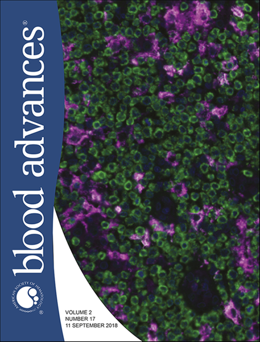 Blood Advances Cover Image for Volume 2, Issue 17