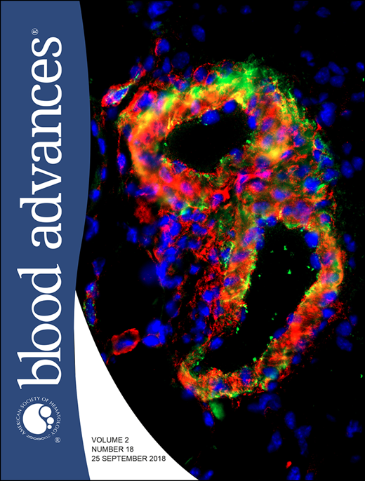 Blood Advances Cover Image for Volume 2, Issue 18