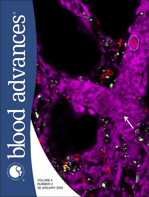 Blood Advances Cover Image for Volume 4, Issue 2