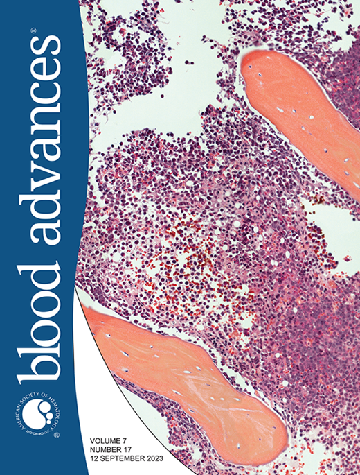Blood Advances Cover Image for Volume 7, Issue 17