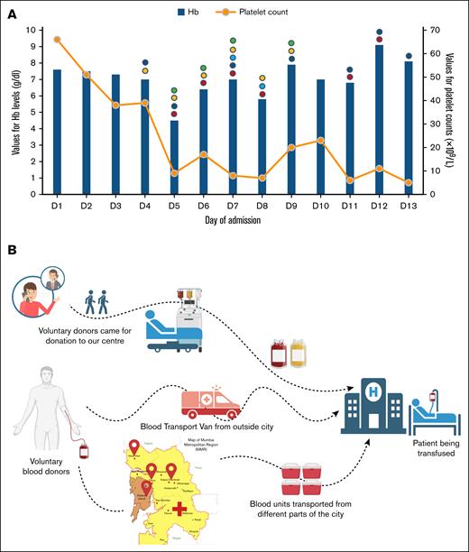 Management of the patient. (A) Patient’s progress in intensive care unit. Circles in the graph depict the different blood products transfused to the patient. Red circles depict PRBC, dark blue circles depict SDP, light blue depicts RDP, yellow depicts fresh frozen plasma, and green depicts cryoprecipitate. The x-axis denotes the day after admission to the intensive care unit, whereas the y-axis on the left denotes the values for the Hb levels, and the y-axis on the right denotes the values for the platelet counts. (B) The process of procurement of the units from various parts of the state for the patient. The illustration in panel B has been independently designed and developed by the authors. RDP, random donor platelets; SDP, single donor platelets.