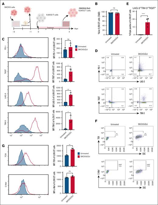 Vγ9Vδ2 T cells treated with SKOV3/Zol show an exhausted phenotype. (A) Scheme of the 4 days coculture in vitro experiment between ex vivo expanded human Vγ9Vδ2 T cells and Zol-presensitized SKOV3 cells. (B) Analysis by flow cytometry of expression of viability marker (7AAD) on ex vivo–expanded human Vγ9Vδ2 T cells before (blue) and after (red) treatment; n> 4 donors. (C) Flow cytometry histogram and mean fluorescence intensity analysis of expression of PD-1, LAG-3, TIM-3 and TIGIT; n = 4 donors. (D) Dot plots from a representative donor of surface expression of PD-1, LAG-3, TIM-3 and TIGIT. (E) Calculated percentage of LAG-3 TIM-3 TIGIT triple positive human Vγ9Vδ2 T cells. (F) Dot plots from a representative donor of intracellular expression of TOX and c-Maf transcription factors. (G) Flow cytometry histogram and mean fluorescence intensity analysis of expression of TOX and c-Maf; n = 3 donors. All statistical analysis was performed using unpaired t tests (∗P < .05; ∗∗P < .003; ∗∗∗P < .0005; ∗∗∗∗P < .0001).