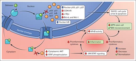 Mechanism of XPO1 inhibition in MF. The figure depicts the mechanism of action of selinexor, a novel XPO1 inhibitor, demonstrating the downstream effects on nuclear and cytoplasmic cell signaling pathways relevant to MF pathobiology. Figure created by Lilas Armstrong-Davies and The Mount Sinai Hospital.